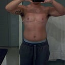3 months post op