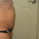 26 days after MTT