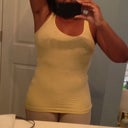 4 days post op