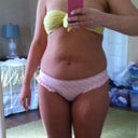 Pre-op front