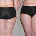 "Before" pics