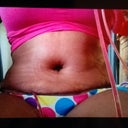 day 5 SUUUUUUUUUUUUUUUPER swollen but I love it so far!