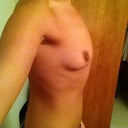 Right side