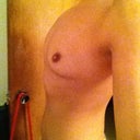 Left side
