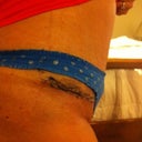 The scar looks SO ugly! The mesh over the suyures makes me look like frankenstein :(