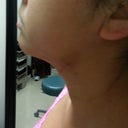day 2..still very swollen