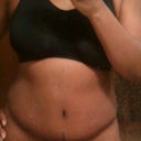 Wk6 TT- morning shot (mild swelling)
