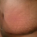 Very swollen Wk6 TT