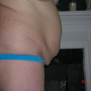 Before picture