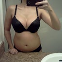post op day 45 :  wearing a 36c bra