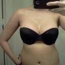 post-op day 45:  strapless, 36b