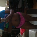 Hey here's the front view! I'm still swollen!! bummer! 6 weeks!