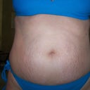 Before, LOTS OF STRETCH MARKS!