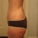 5 Weeks Rt Side