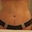 5 Week Belly Button