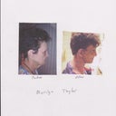 before and after pictures of neck in profile