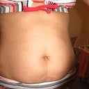 Before procedure