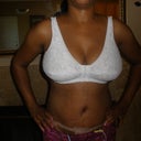6 Days Post-op and the curves are forming!