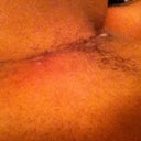 Other arm