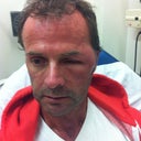 before surgery