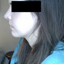 11 Days after