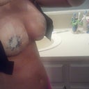 Day 4 Right Bare