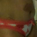 The other side, this scar is not so high but you can see the dog ear on my right side.