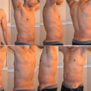 28 days out from Power Assisted Lipo, 13 days out from Smart Lipo.