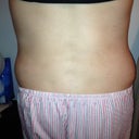 And, here is a back picture.  I had lipo of my flanks, and I alm still pretty swollen back here, but I can see a little bit of shape.  My torso used to look like a box from the back... so there's a little improvement!