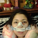 DAY 1- Night of the surgery day. Had no bruising when I came out of surgery, but it's starting to now.