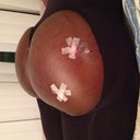 Day jan 25-13 surgery day