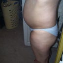 The day before surgery 