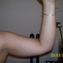 The day before surgery