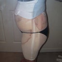 a few hours after surgery