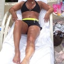 16 months after surgery
