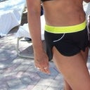 abdomen 16 months after surgery