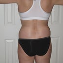 After-back 1 month