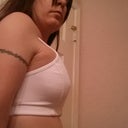 Day 1 post op 6/12