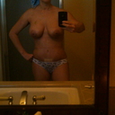 7/26/11  20 days post op.  Brusing is much better!  Still swollen, still not completely upright, but I can see things improving!  bandaid is for a small infection on incision site :(