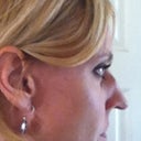 Side Before