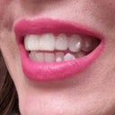 I wouldn't even care about the clear trays. It's just the very visible aligner buttons that I hate.