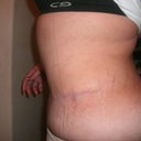 side view i just ate so my upper stomach is swolen lol.