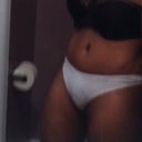 2 month post op. you can see the the 6 pack forming.