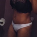 2 month post op.