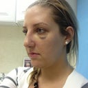 Hump still? Or ridiculous swelling?? Who knows.