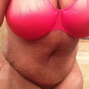 One day post op
