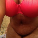 One day post op