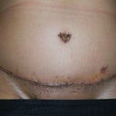 PO Day 7 - ONE WEEK!!!!!!!!