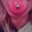 Thrush of the mouth :( Day 5