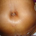 Close up of new belly button on day 2